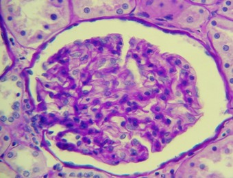 Células y Matriz Mesangial. Membrana Basal